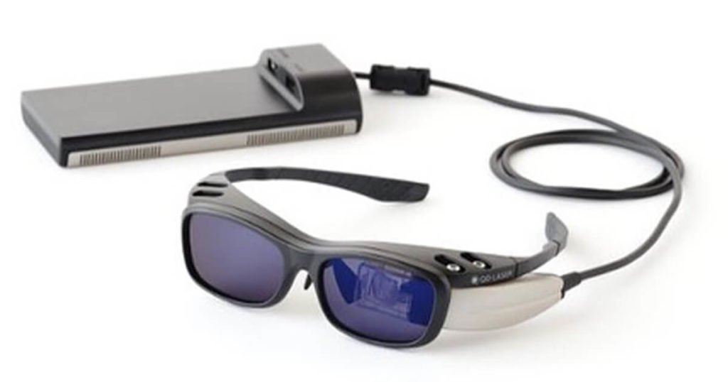 レティッサ ネオビューワの画像02